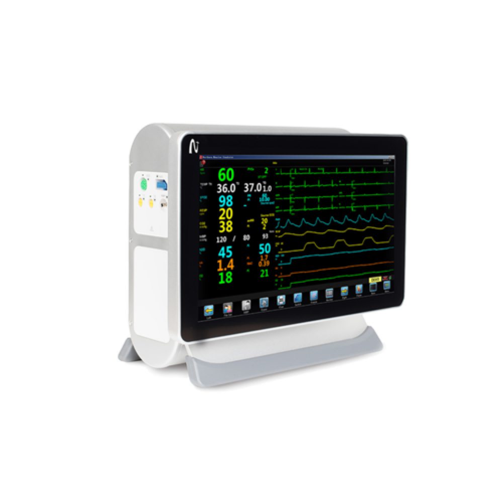 Monitor Gemini
